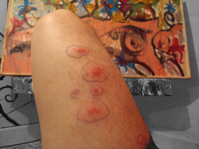 maybe it's a rash